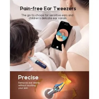 earsight plus i35r smart visual ear wax removal tool with camera and tweezers