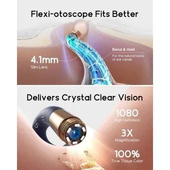 earsight plus i35r smart visual ear wax removal tool with camera and tweezers