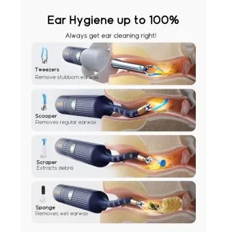 earsight plus i35r smart visual ear wax removal tool with camera and tweezers